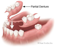 Cosmetic Treatments Santa Barbara Dental Spa-1 Cosmetic Treatments Santa Barbara Dental Spa-1