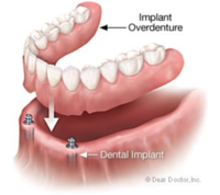 Cosmetic Treatments Santa Barbara Dental Spa-3 Cosmetic Treatments Santa Barbara Dental Spa-3