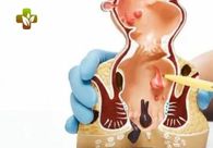 A great web design by Dr. Piles Clinic, New Delhi, India: Health & Beauty
