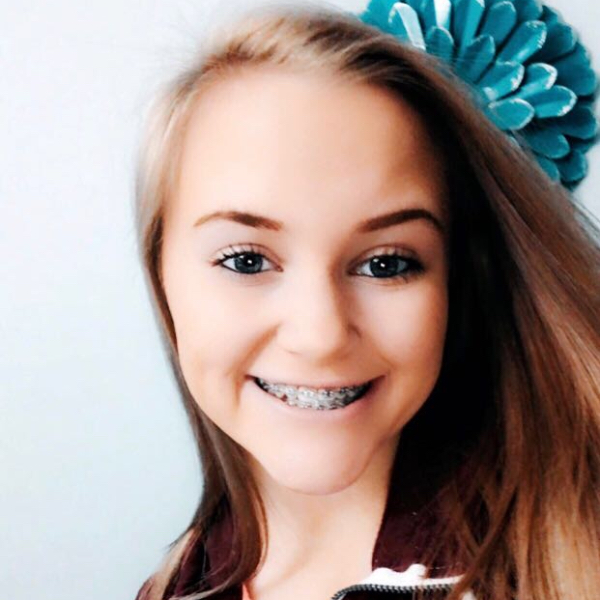 Alli Schupp