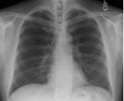xray