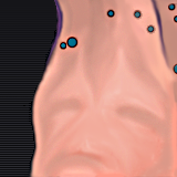 jimmy the spam-faced boy by Kilgore