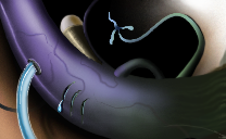 Ambrosia Square Knot by empyrean