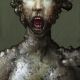 Deformity