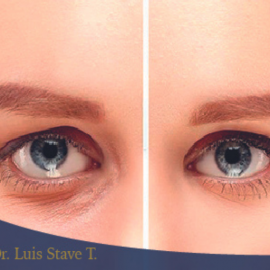 Stave Tapia Luis Enrique