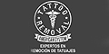 Tattoo Removal Americam System - Expertos en Eliminacion Laser de Tatuajes