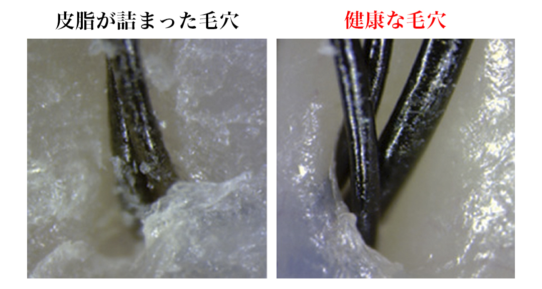 毛穴に詰まった皮脂や、髪に絡んだホコリを、しっかりかき出しながら、頭皮をマッサージしてくれ｜男性の髪と頭皮のための『572（ゴーナナニ）』のシャンプー、トリートメント、育毛剤、スカルプブラシ
