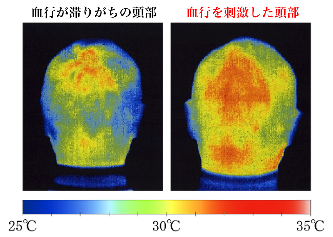 シャンプーを流し終わった後は、アタマ全体がじんわり暖まって、スッキリ軽く感じる｜男性の髪と頭皮のための『572（ゴーナナニ）』のシャンプー、トリートメント、育毛剤、スカルプブラシ