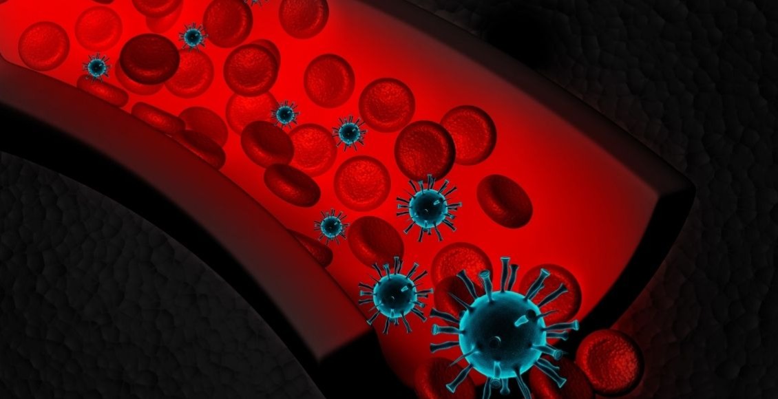 La sepsis qué es y cuáles son sus síntomas