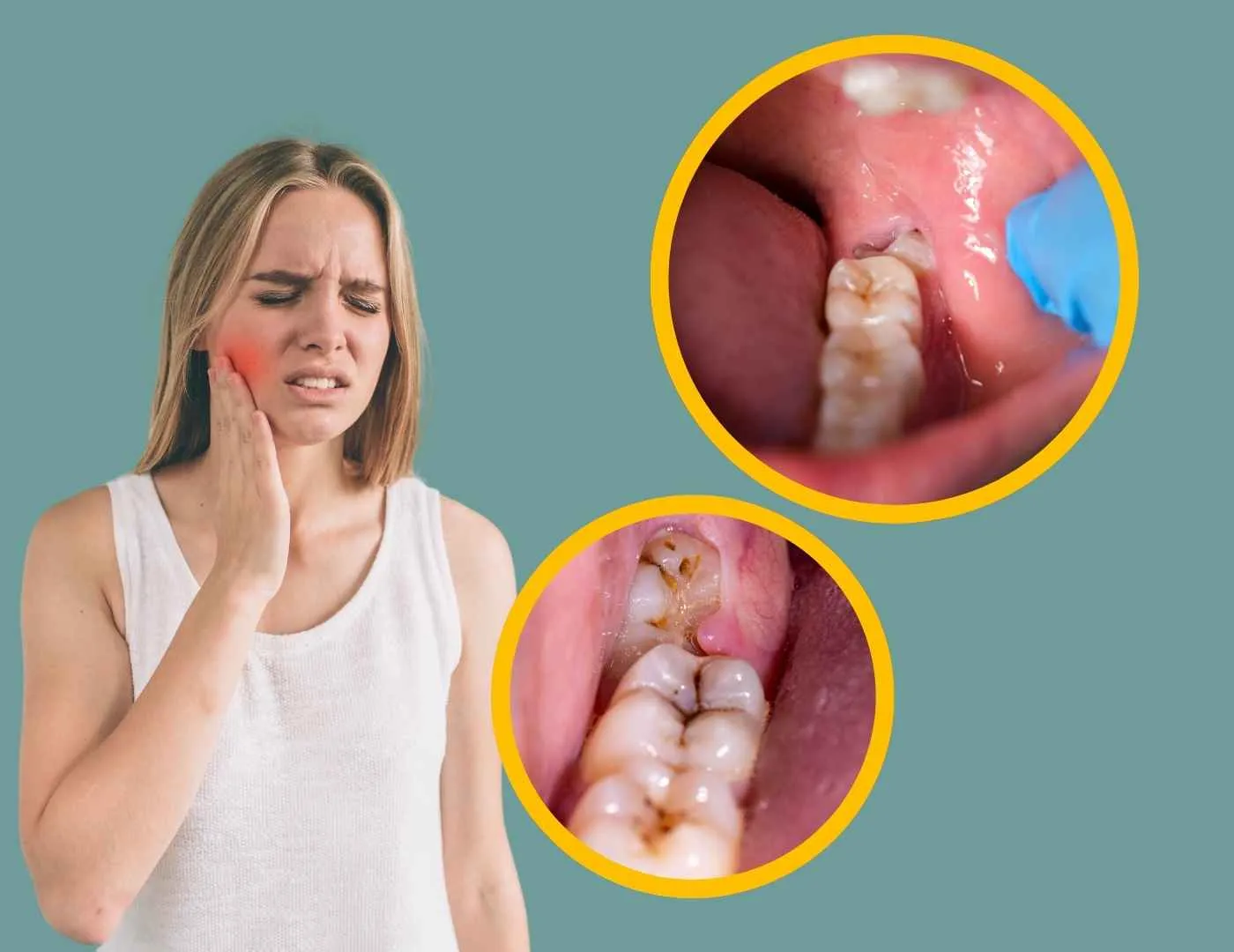 Tooth Extraction in East Village NYC | Tooth Removal