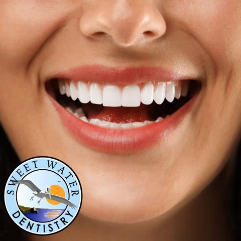 Service: Oral Sedation Dentistry Location: Sweet Water Dentistry – Fairhope, AL
Completed an appointment using oral conscious sedation for a patient with dental anxiety. They were calm, comfortable, and relieved when everything was finished. Searching for sedation dentistry in Baldwin County? We make dental visits stress-free.