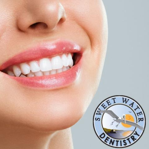 Just completed a fractured cusp extraction for a tooth too damaged to save. If you need quick, gentle tooth removal in Fairhope, Sweet Water Dentistry is here for you.
