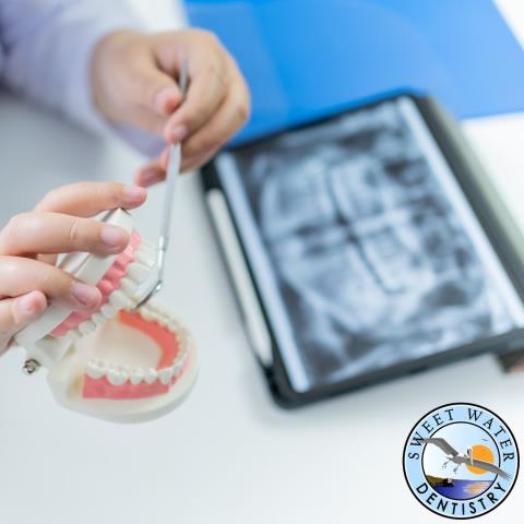 Service: Tooth Extraction Location: Sweet Water Dentistry – Fairhope, AL
Just assisted with a tooth extraction in Fairhope, AL today at Sweet Water Dentistry. The patient did great, and we made sure they were comfortable the entire time. If you need a gentle tooth extraction in Fairhope, Daphne, or Spanish Fort, our team is here to help relieve pain quickly and safely.