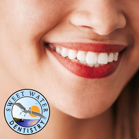Service: Tooth-Colored Filling Location: Sweet Water Dentistry – Fairhope, AL
Assisted Dr. Greer with a tooth-colored composite filling in Fairhope, AL. We restored the tooth to full function and a natural look — no metal fillings here! If you’re searching for white fillings, cavity repair, or cosmetic bonding in Fairhope, we’re happy to help.