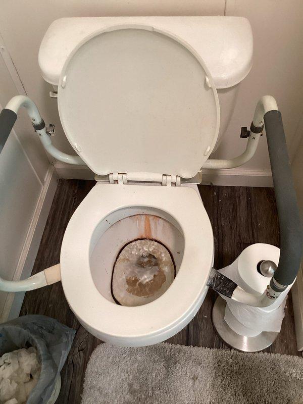 Responded to service call for overflowing toilet. Upon arrival, inspected toilet bowl and drain assembly, noting visible staining and debris accumulation around the interior surfaces and drain opening. Examined the flush mechanism and identified blockage causing overflow condition. Cleared obstruction from drain line and verified proper water flow and drainage. Tested flush cycle multiple times to ensure complete resolution of overflow issue. Toilet restored to normal operating condition with no further signs of backup or overflow.