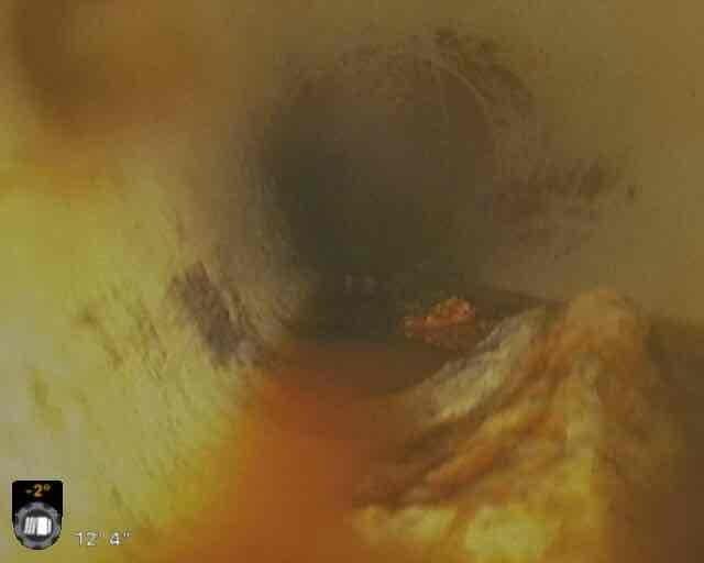 Completed sewer scope inspection as requested after customer cleared rocks from line. Camera inspection revealed significant pipe deterioration with extensive rust and corrosion throughout the system. Observed standing water and debris approximately 12 feet into the line, with visible metal fragments partially submerged, indicating potential structural compromise requiring professional attention. Completed sewer scope inspection as requested after customer cleared rocks from line. Camera inspection revealed significant pipe deterioration with extensive rust and corrosion throughout the system. Observed standing water and debris approximately 12 feet into the line, with visible metal fragments partially submerged, indicating potential structural compromise requiring professional attention.