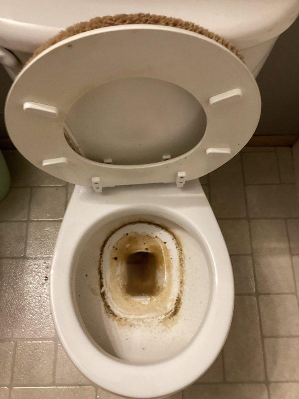 Responded to service call for a plugged toilet reported as "exploded." Upon inspection, found significant mineral deposits and waste buildup in the toilet bowl. Performed snaking procedure to clear the obstruction. No additional plumbing issues detected elsewhere in the home. Recommended toilet replacement due to extensive staining and potential ongoing drainage issues.