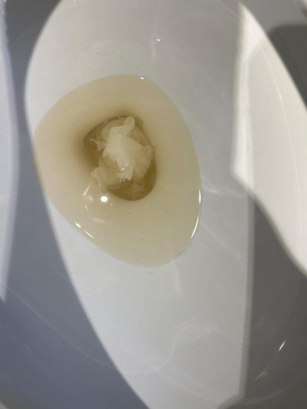 Responded to service call for non-flushing smart toilet with integrated bidet system. Upon arrival, found toilet bowl containing standing water with debris, indicating flush mechanism failure. Inspected electronic bidet unit with digital control panel and determined malfunction in smart toilet's flushing system. Diagnosed issue, cleared blockage, and restored proper flushing function to the electronic toilet fixture, verifying all bidet controls and flush operations returned to normal working condition.