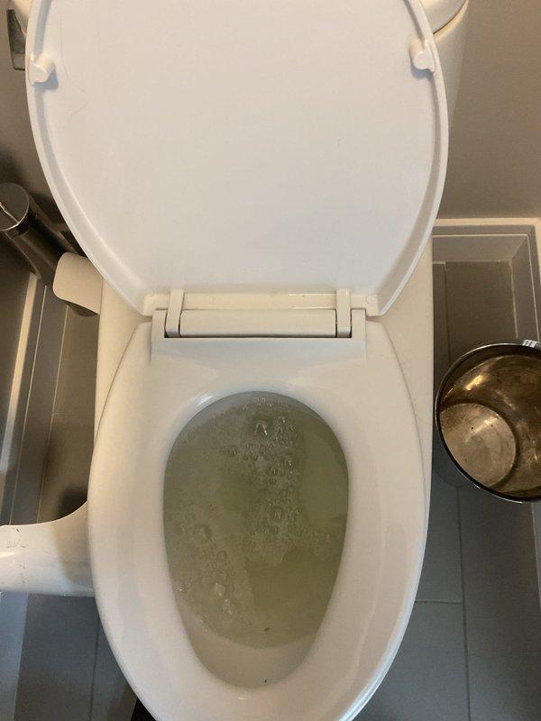 Responded to a third-floor toilet that had been clogged for five days after multiple unsuccessful attempts to clear the blockage. Upon arrival, found standing water in the bowl with visible discoloration and debris, indicating a significant obstruction in the drain line. Successfully cleared the clog using professional plumbing tools, restored proper drainage and flushing function, and verified the fixture was operating normally before completing the service.