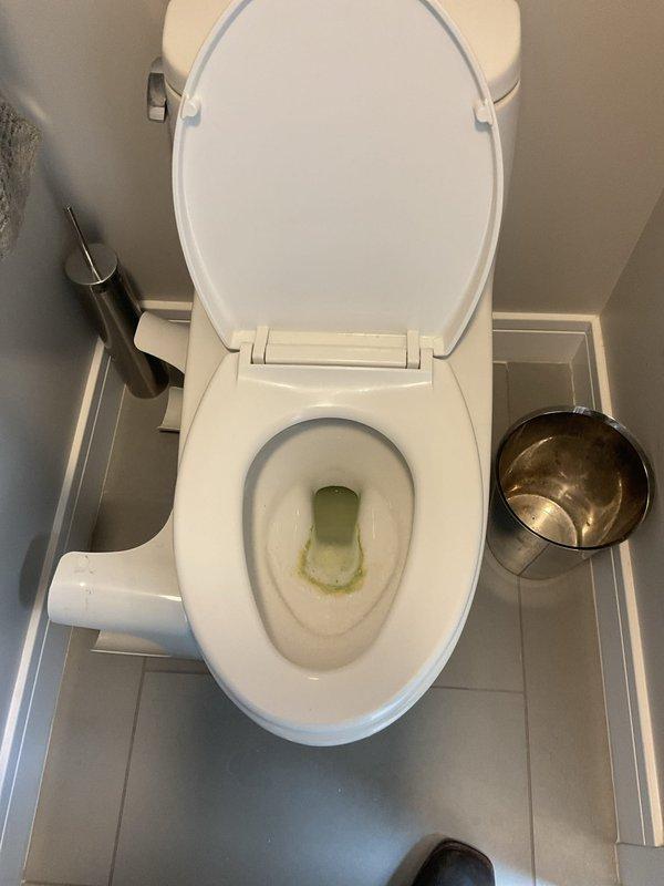 Responded to a third-floor toilet that had been clogged for five days after multiple unsuccessful attempts to clear the blockage. Upon arrival, found standing water in the bowl with visible discoloration and debris, indicating a significant obstruction in the drain line. Successfully cleared the clog using professional plumbing tools, restored proper drainage and flushing function, and verified the fixture was operating normally before completing the service.