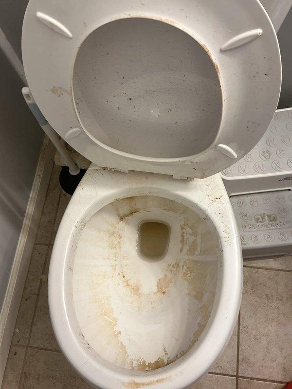 Responded to a toilet backup in the master bathroom caused by a flushed nose hair trimmer. Successfully removed the obstruction using a closet auger, restoring proper drainage and flush function. Verified the blockage was isolated to the affected fixture with no additional drainage issues present in the home's plumbing system.