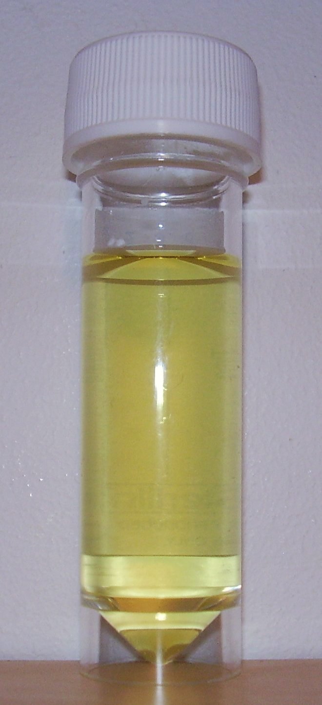 urine general test