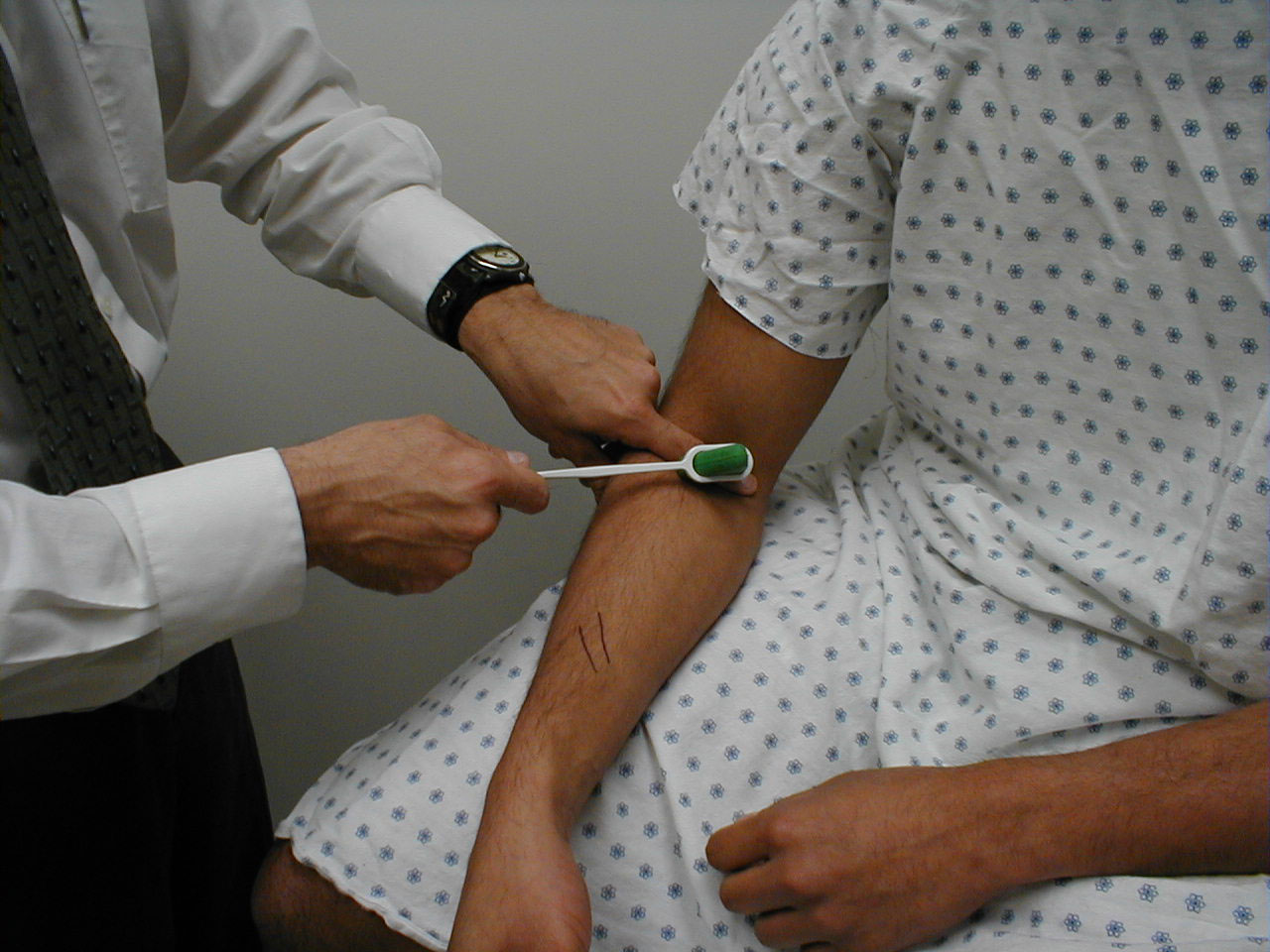 рефлекс молоточком. патологический рефлекс бехтерева. карпорадиальный локтевой рефлекс. патологические кистевые рефлексы россолимо жуковского. рефлекс вартенберга.