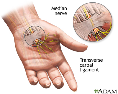 View inside the crowded carpal tunnel space.