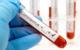 Coronavirus Roundup