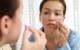 5 Secrets to Lovely Clear Skin