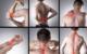 Combating Chronic Inflammation