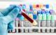 Blood Test Screens for 50 Cancers