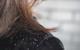 5 Home Remedies for Dandruff