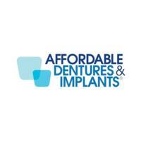 Affordable Dentures & Implants