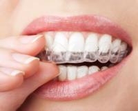 Graceful Smile Dentistry Rosenberg TX