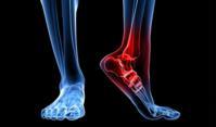 Podiatrist Miami FL