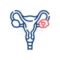 Ovarian Cancer Hyderabad