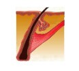 Hairtransplantguwahati