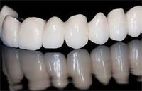 Chapel Hill Dentist