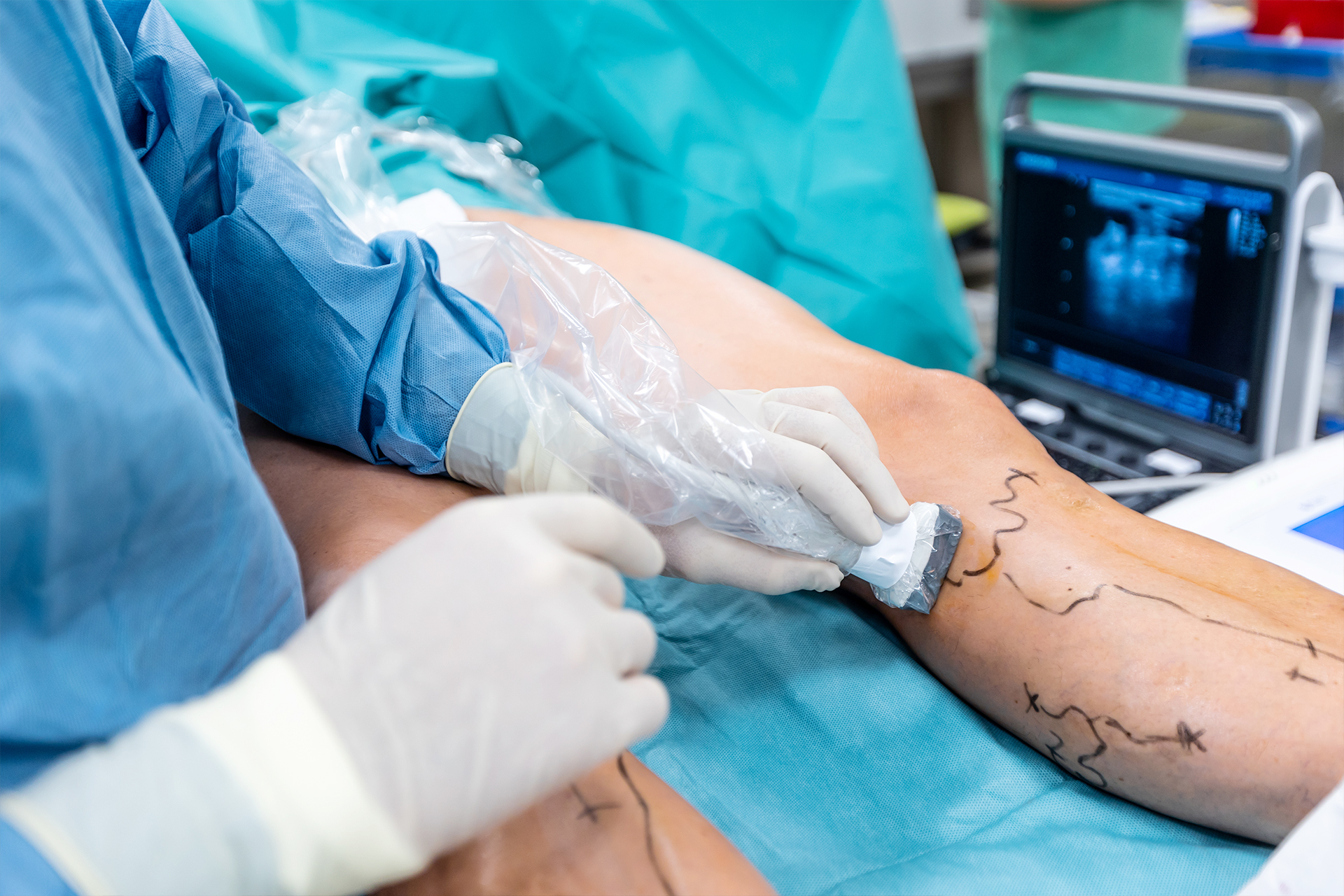 Vascular Surgery