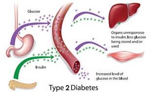 diabetes stem cell treatment