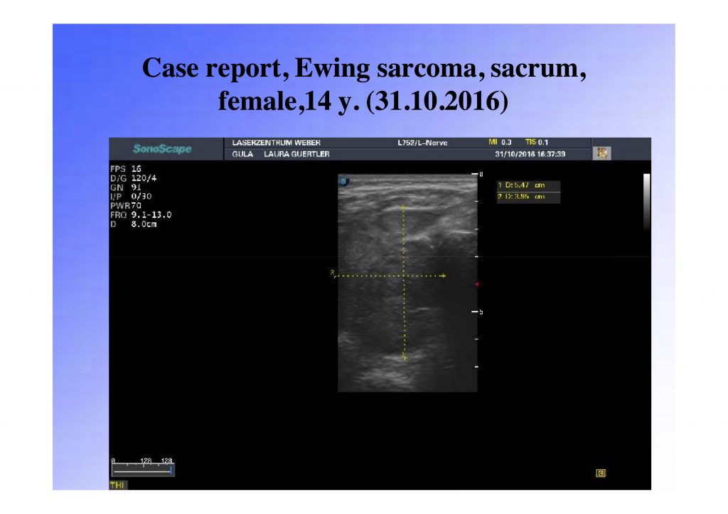 pancreatic pdt cancer treatment, pdt cancer treatment, photodynamic cancer treatment, alternative cancer treatment,