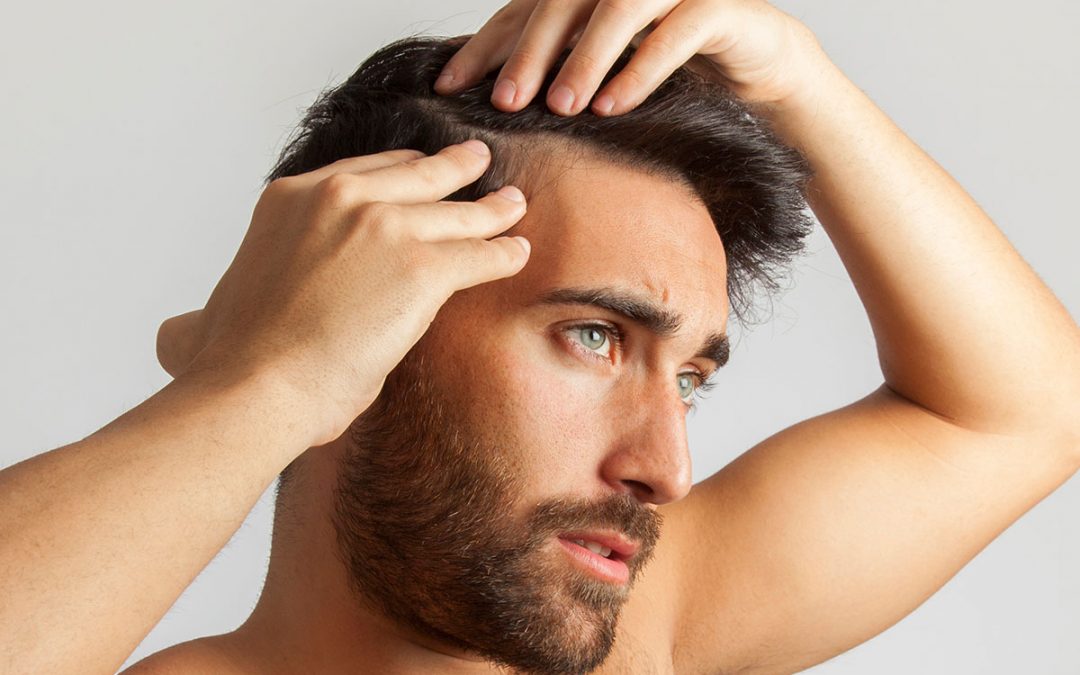 Baldness Stem Cell Therapy