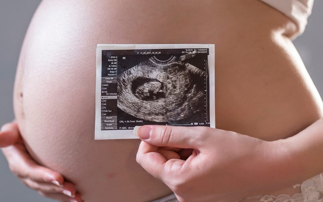 In Utero Stem Cell Transplant