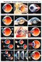 Cataract & Refraction Wall Chart #1 of 2 - Physician-Patient Consultation Illustrations