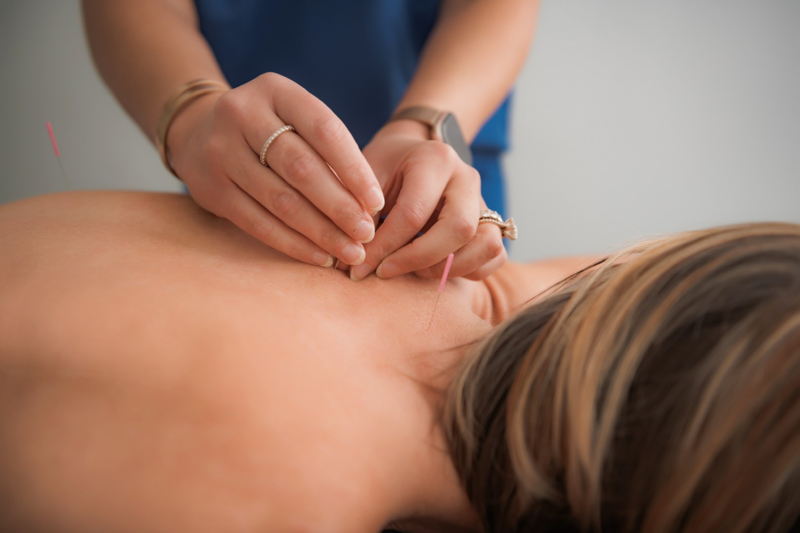 Acupuncture - Body &amp; Soul Acupuncture in Huntingtown, MD