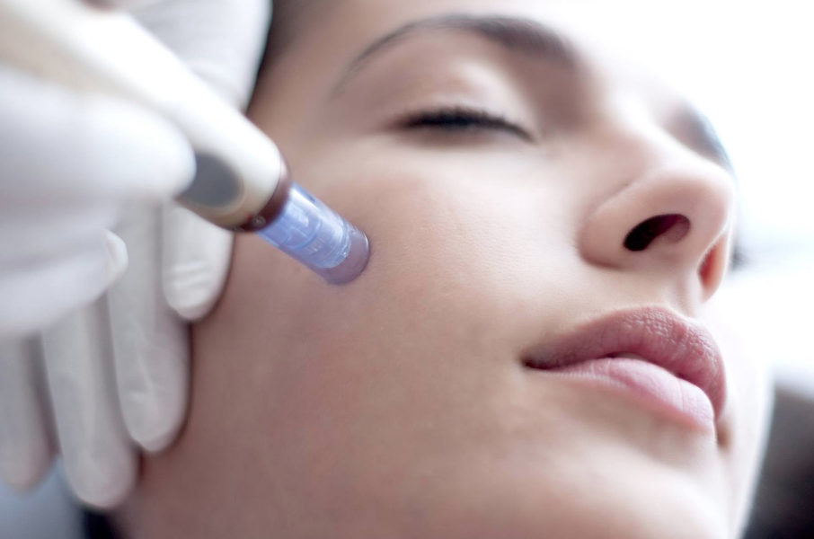 More about Microneedling - Carroll Acupuncture Clinic in Eldersburg, MD