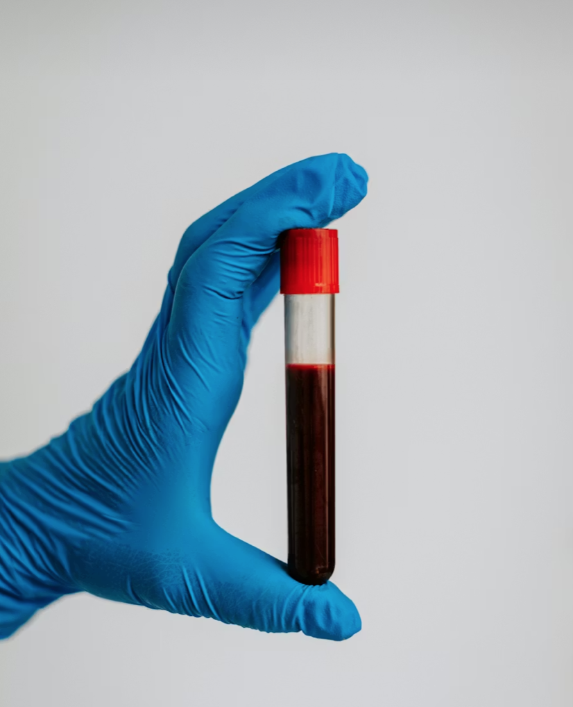 Phlebotomy Services - Marin Holistic Health &amp; Acupuncture in Fairfax, CA