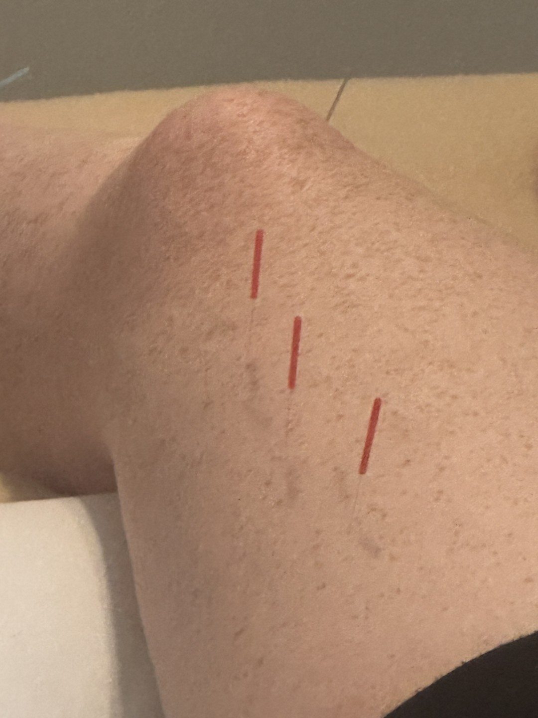 Noah Samuels LAC PC offers safe, effective Acupuncture in Washington, DC
