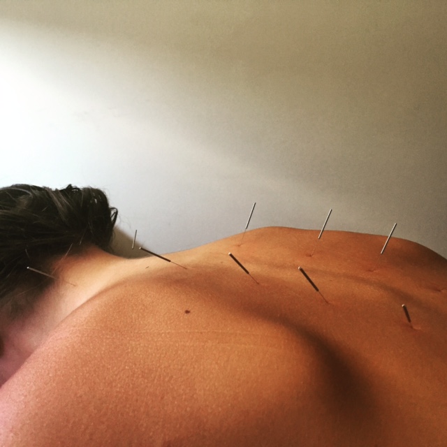 Gabe Schiff-Verre offers Acupuncture, massage, cupping, chinese herbs in South Portland, Maine